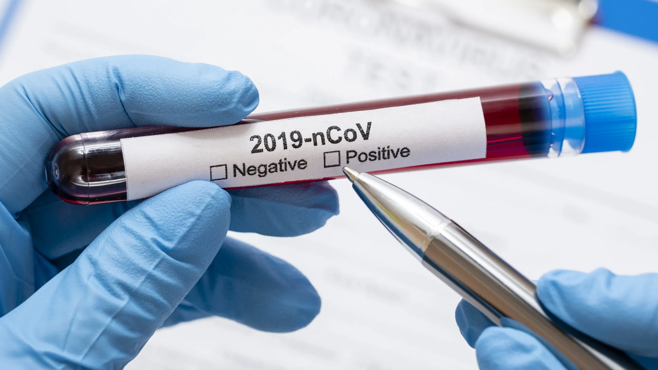 Оплата тестирования работников на коронавирус можно учесть в расходах